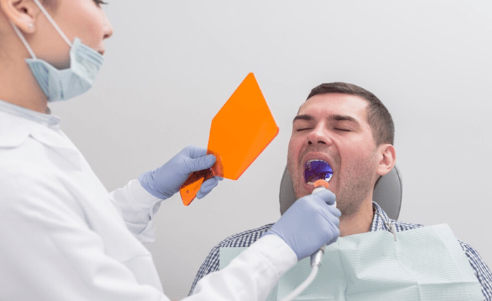 The Ultimate Guide to Dental Implants in Sheffield