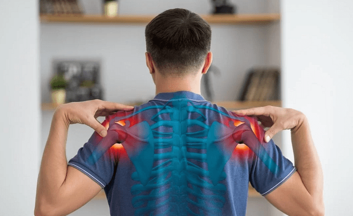 Four Remedies For Frozen Shoulder And Everything You Should know About Them